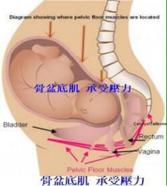 產(chǎn)后盆底康復(fù)治療開始后，出現(xiàn)陰道出血怎么破？