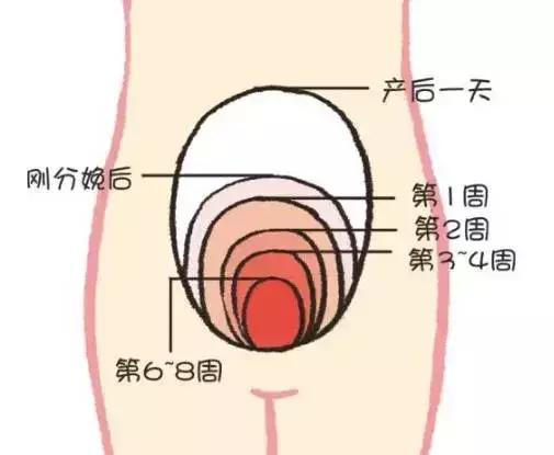 產(chǎn)后康復(fù)，什么叫子宮復(fù)舊不良？