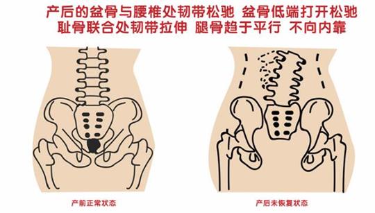 自從知道產(chǎn)后康復(fù)治療儀后，再也不怕腹直肌修復(fù)了