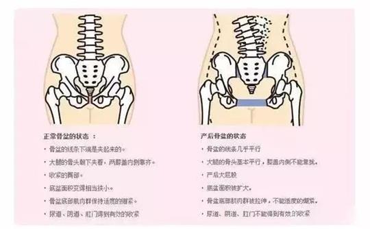 產(chǎn)后修復(fù)治療儀器對(duì)于腹直肌修復(fù)有效果嗎？