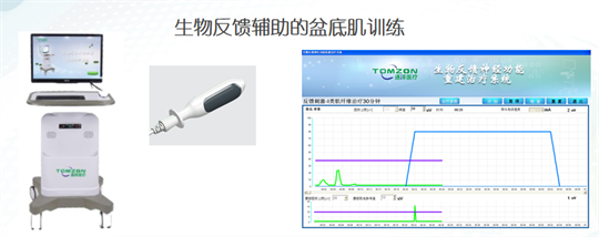 產(chǎn)后修復(fù)|盆底肌肉功能電刺激有什么作用？生物反饋呢？