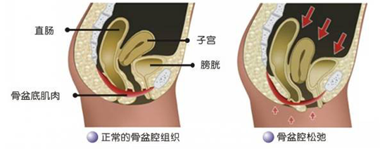 盆底功能檢測很重要，盆底肌松弛了會有什么表現(xiàn)呢？