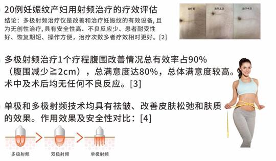 通澤產(chǎn)后塑形儀器，多極射頻破解辣媽逆齡秘訣