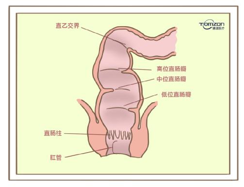 盆底康復(fù)治療儀對(duì)產(chǎn)后便秘有哪些幫助？