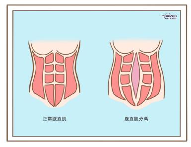 盆底康復(fù)治療儀效果到底怎么樣？