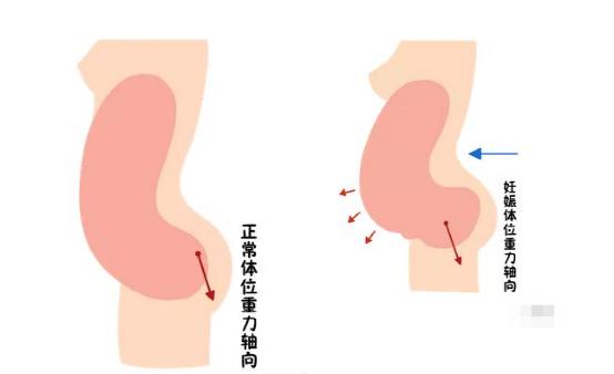 盆底康復(fù)治療儀.jpg